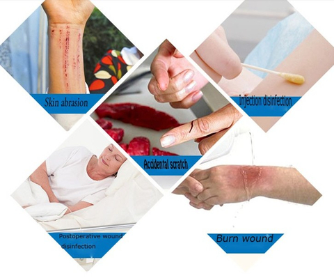 99.99% Sterilization 30ppm Colloidal Nano Silver Antibacterial Spray Applied To Burn Wound Care Treatment